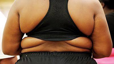 Journée Mondiale de lutte contre l’obésité : Les femmes appelé à veiller sur leur poids car l’obésité est une maladie grave